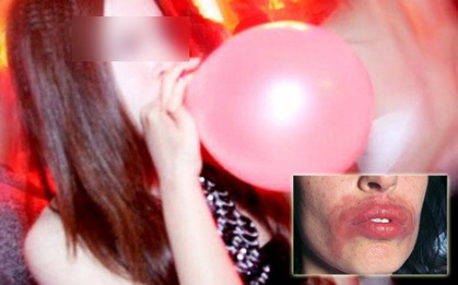 Giật mình khi biết sự thật về bóng cười chẳng hay ho như bạn tưởng