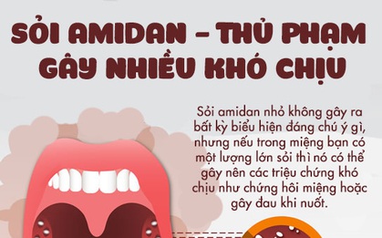 Ngoài thận, bạn có biết rằng mình cũng có thể có sỏi trong amidan không?