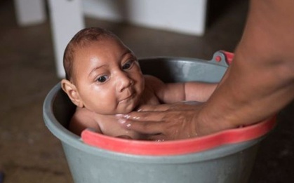 Bộ Y Tế: Đã giao các bệnh viện nghiên cứu về thông tin "virus Zika có thể gây rối loạn não người lớn"