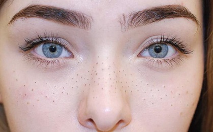 Hết makeup tạo đốm tàn nhang giả, nay con gái còn xăm hẳn tàn nhang lên mặt