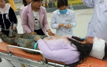 Đang đi học, nữ sinh 16 tuổi vô duyên vô cớ bị kẻ lạ mặt hành hạ dã man dẫn tới mù mắt