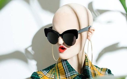 Gặp gỡ người mẫu đột biến gen xấu lạ đã phá vỡ chuẩn mực cái đẹp thời trang