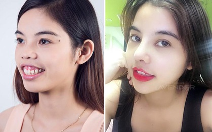Những ca biến hình ngoạn mục nhờ phẫu thuật thẩm mỹ