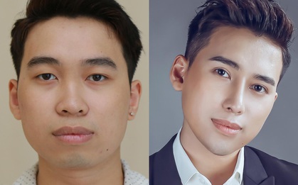 Những ca phẫu thuật thẩm mỹ hot nhận được nhiều chú ý của cộng đồng mạng