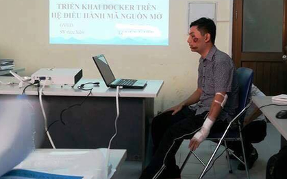 Sinh viên ĐH Mỏ - Địa chất: Thương tích đầy người vẫn bảo vệ thành công đồ án tốt nghiệp