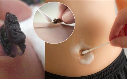 Đảm bảo bạn sẽ đi vệ sinh rốn ngay sau khi biết sự thật hoảng hồn này