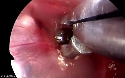 Nguy cơ bị "sinh vật lạ" ký sinh trong tai chỉ vì một thói quen thường gặp của những người nuôi chó
