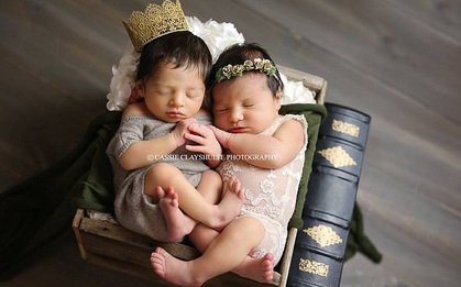 Định mệnh sinh ra là để dành cho nhau của cặp đôi sơ sinh Romeo và Juliet