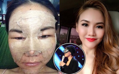 3 năm gặp lại, thí sinh X-Factor đeo mặt nạ gây xôn xao đã hoàn toàn lột xác nhờ thẩm mỹ
