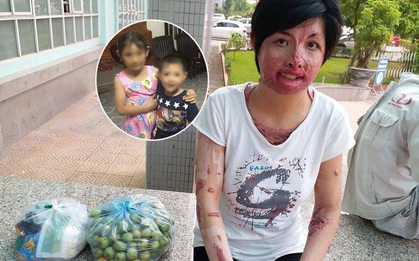Gặp lại người phụ nữ từng bị chồng nhốt, tẩm xăng thiêu sống: "Tôi không còn oán hận, chỉ mong có ngày đoàn tụ với con"