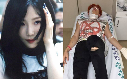Bị sàm sỡ, bỏng nặng, tai nạn ô tô liên tiếp: Vấn đề an toàn của nghệ sĩ thật sự đáng báo động