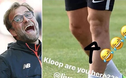 Trên đầu gối của Pato có gương mặt HLV Jurgen Klopp