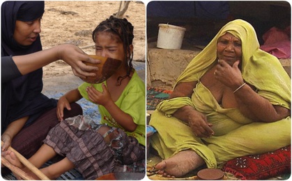 Ghé thăm nơi vỗ béo phụ nữ tại Mauritania - khi chuẩn mực cái đẹp trở thành cực hình