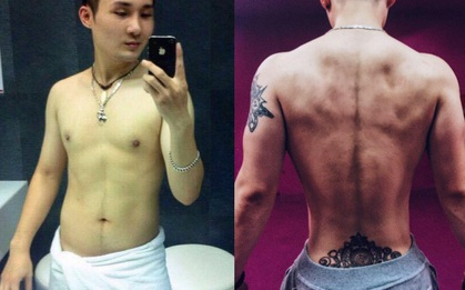 Bất chấp đau đớn, chàng trai Hà Nội chi 750 triệu đồng cắt bỏ xương sườn để có vòng eo bé xíu