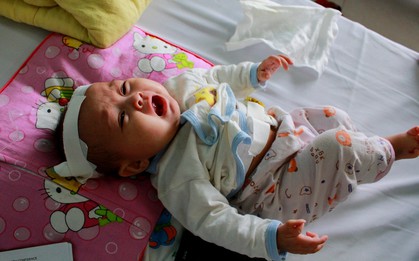 Xót thương bé gái 6 tháng tuổi chỉ nặng 4kg lại phải chịu nhiều dị tật trên cơ thể