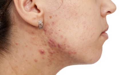 “Tử thần thầm lặng” mang tên khói bụi mà ngày nào bạn cũng gặp phải thực sự nguy hiểm đến đâu?