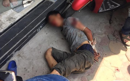 Vụ đối tượng cầm dao đâm người ở Hà Nội: Nghi do nắng nóng nên bệnh thần kinh tái phát