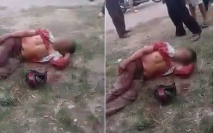 Tài xế xe ôm bị cướp đâm, bò ra đường quốc lộ kêu cứu