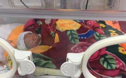 Hi hữu: Bé gái sinh ra vẫn còn nguyên trong túi nước ối