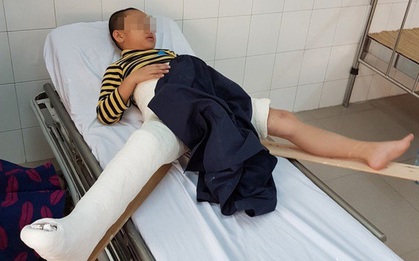 Hai "sự thật" của cô hiệu trưởng về vụ xe đâm học sinh gãy chân