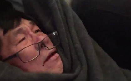 Bác sĩ gốc Việt có đủ cơ sở pháp lý để thắng kiện United Airlines hàng triệu USD