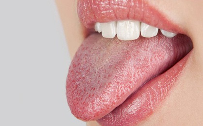 9 biện pháp khắc phục và ngăn ngừa tình trạng khô miệng bạn hoàn toàn có thể làm ở nhà