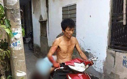 Truy tố người cha chở xác con rể lên phường