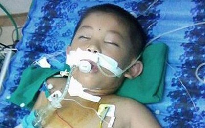 Bị cả trăm con ong vò vẽ đốt khắp người, cháu bé nhập viện, hôn mê