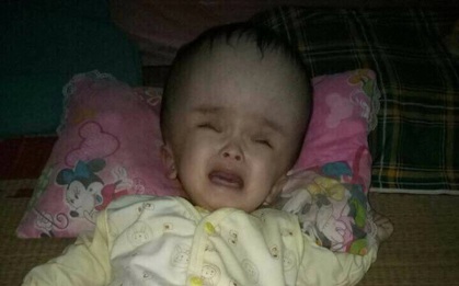 Nỗi lòng người mẹ có con bị não úng thủy: “Để cứu con, mẹ sẵn sàng lạy cả thế giới”