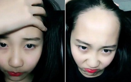 Cuộc đời vẫn còn đẹp chán, khi "trán sân bay" đã có tóc mái lo rồi!