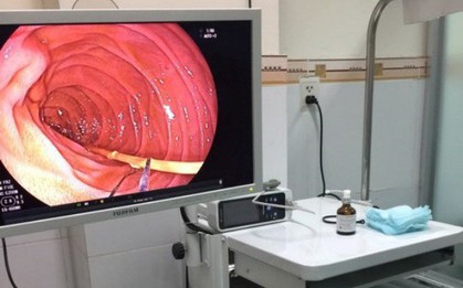 TP.HCM: Nhậu xỉn, người đàn ông 35 tuổi nuốt luôn 6 cây nhang, 1 khối cẩm thạch vào bụng vì… thiếu mồi