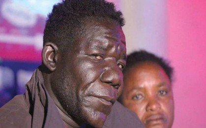 Ngắm dung nhan phát hờn của người đàn ông đạt giải Nam Vương Xấu Nhất Zimbabwe