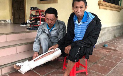 Con trai đánh bố gãy xương, bầm tím khắp người: "Nó còn mang xăng định đốt cả bố"