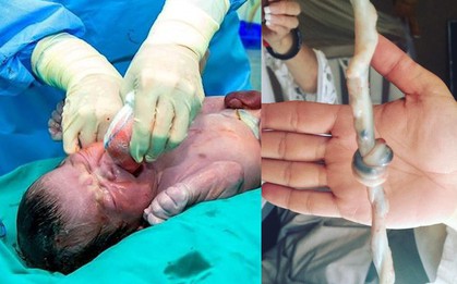Vừa đón em bé chào đời, bác sĩ hét lên "Bố đâu, nhanh đến chụp ảnh, con anh là một phép màu"