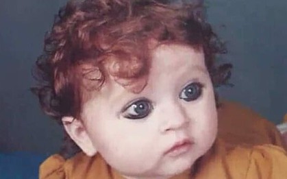 Sinh ra bị coi là "quái vật" vì ngoại hình khác thường, 20 năm sau ai cũng phải trầm trồ vì sắc đẹp của cô