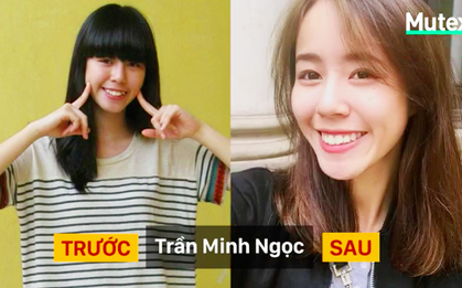 Sức mạnh của niềng răng: khiến chúng ta dậy thì thành công ngoài sức tưởng tượng
