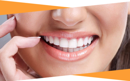 Niềng răng đau lắm nhưng nhìn thành quả thế này ai chẳng thích niềng