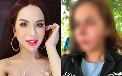 Lin Da - hotgirl chuyển giới 1 triệu followers bất ngờ chia sẻ ảnh mặt biến dạng sau khi nạo silicon