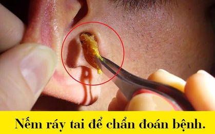 Biết người Hy Lạp cổ sống "quái dị" thế này, bạn sẽ thầm cảm ơn vì đang sống ở thế kỷ 21