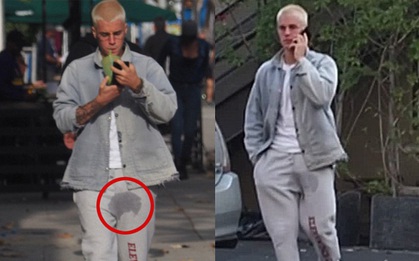 Bị phát hiện có vết ướt, Justin Bieber tự chế nhạo mình tiểu ra quần