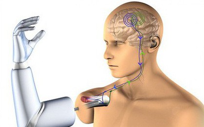 Mất một tay ư? Chẳng sao cả, vì não bạn sẽ nhanh chóng huấn luyện phần cơ thể khác làm công việc đó