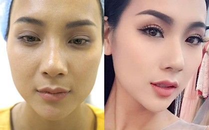 Hotgirl Việt và quyết định nâng mũi, cắt mí đổi đời