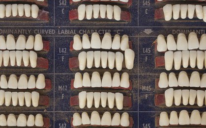 Góc kinh dị: Một đội thợ hồ ở Mỹ vừa tìm thấy khoảng 1000 chiếc răng người giấu trong tường