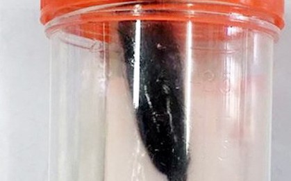 Phát hiện con đỉa dài 5cm sống trong đường thở bé gái 9 tuổi