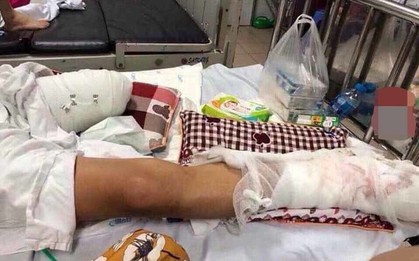 Vụ thanh niên bị truy sát chém nát chân: Nghi do mâu thuẫn trong hoạt động cho vay tín dụng đen