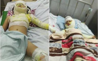 Bố nướng mực cháy nhà khiến con 2 tuổi tử vong, 3 người khác nhập viện