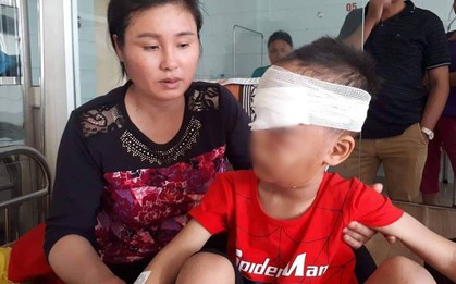 Chó nhà bất ngờ lao vào cắn nát vùng mặt cháu bé 6 tuổi