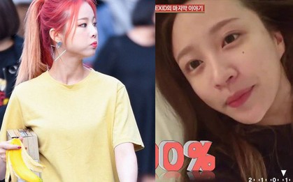 Đại tỷ nhà Exid - Solji nhận đủ gạch đá để xây biệt thự vì thẳng thắn chê Hani không make trông xấu như bà già