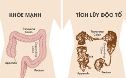 Tiến sĩ Nguyễn Khánh Hòa phủ nhận Detox, cảnh báo rất nhiều tác hại