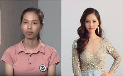 "Mặt xấu xí như vậy chỉ đem lại vận xui" - lời từ chối khi xin việc và màn "lột xác" ngoạn mục của cô gái trẻ khiến bao người ngỡ ngàng